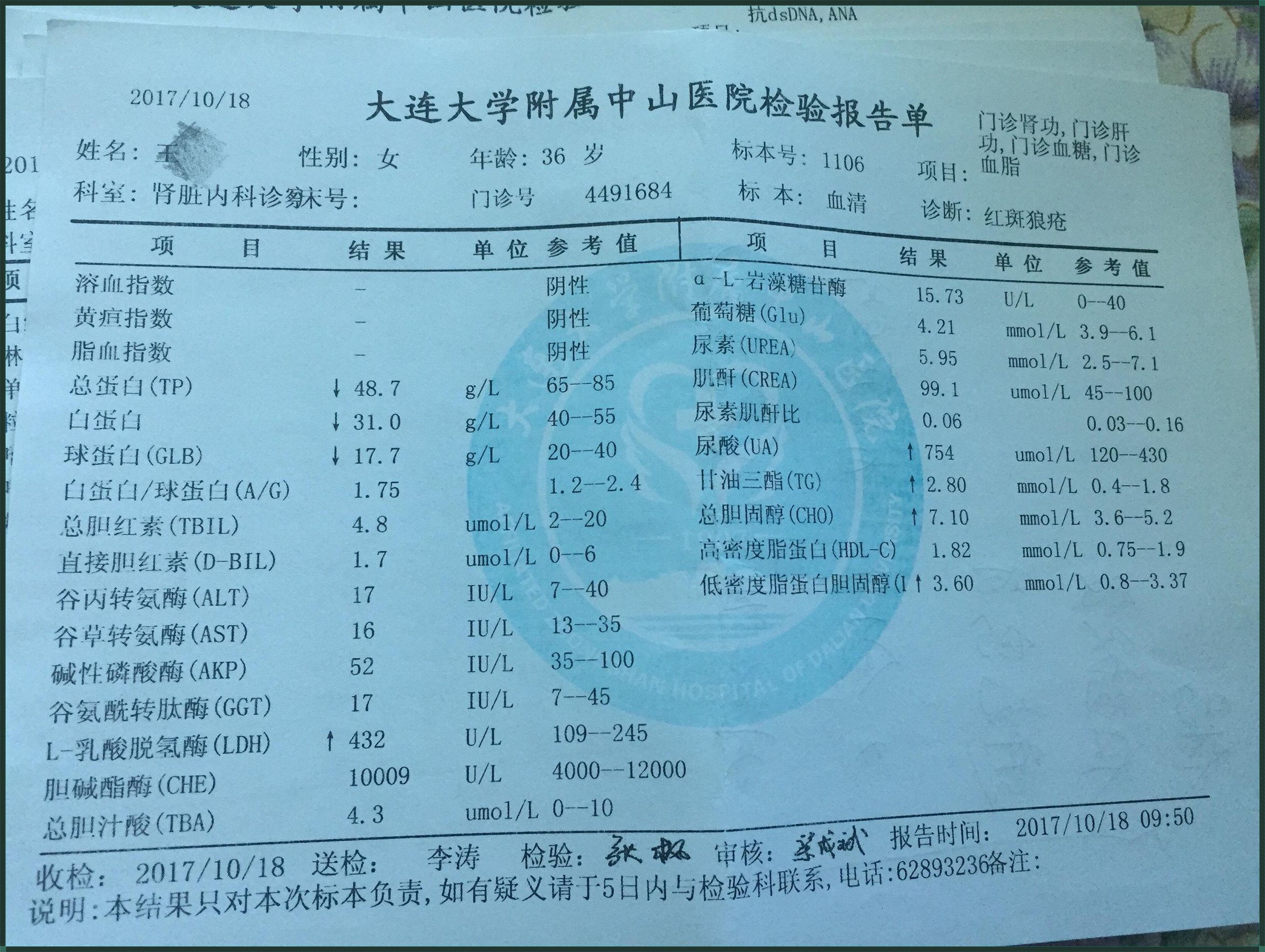 红斑狼疮检测揭秘，专家带你走进诊断新篇章