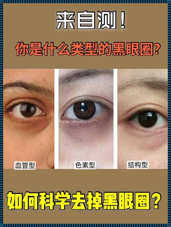 熊猫眼背后的故事：代表的意义与启示