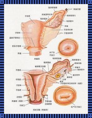 附件炎疼痛之谜：两侧还是左侧？