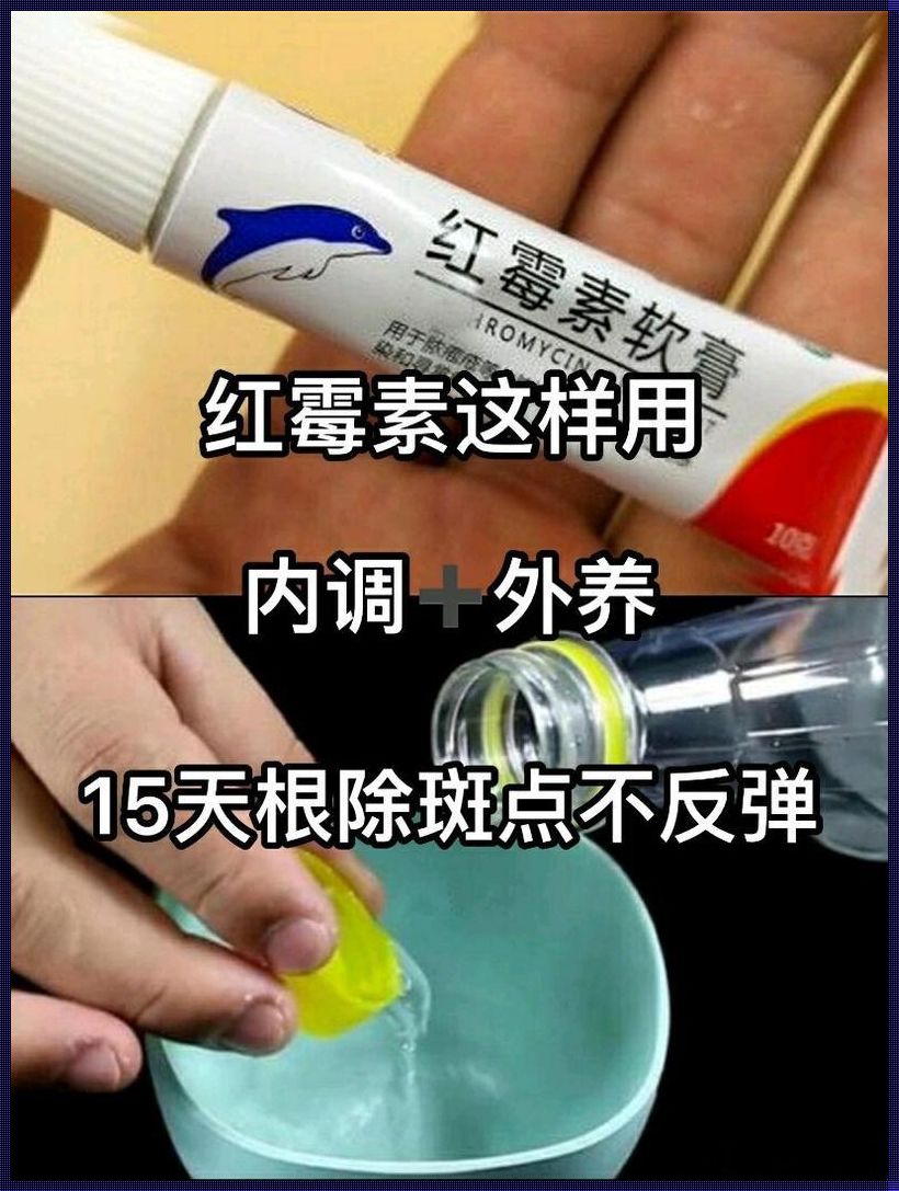 红霉素加一物，一周祛斑不是梦！