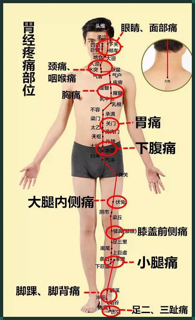 人体疼痛对照表图：火爆背后的秘密