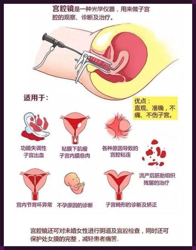 敦煌文化惊现宫腔灌注的功效和作用