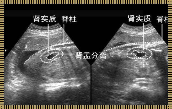 探秘B超单：辨识男女的秘诀与智慧