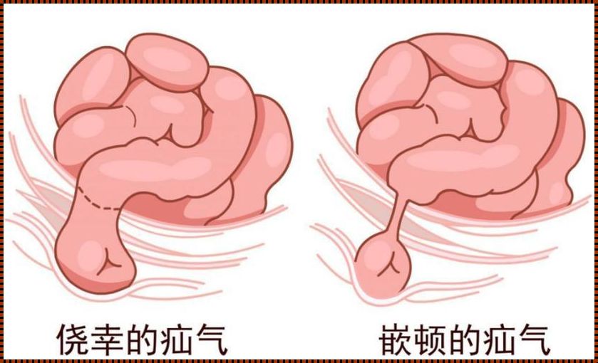 小孩小肠气的惊现——探索背后的奥秘与应对之策