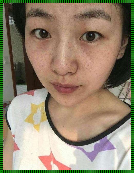 女人脸上不干净意味着什么