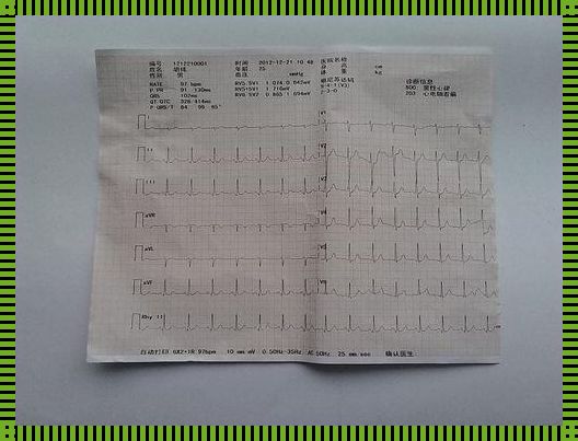 做个心电图要多少钱