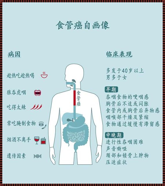 深入了解上食道癌早期症状，为健康保驾护航