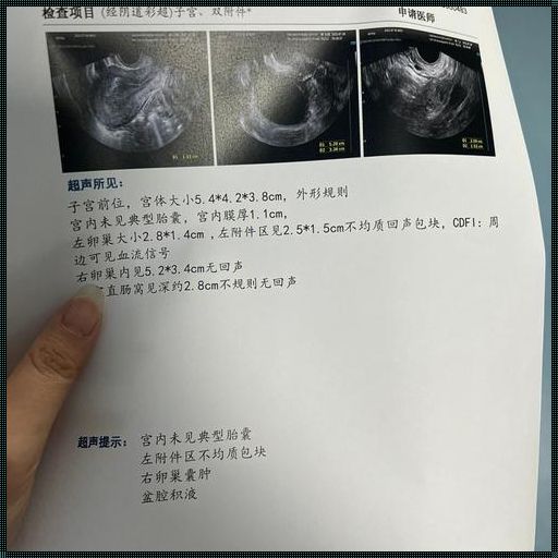 “我以为生化妊娠了，结果宫外孕”：一次生命的转折与思考