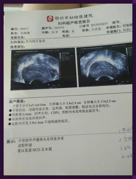 胎停还没清宫就流血了怎么办——我的亲身经历与深度剖析