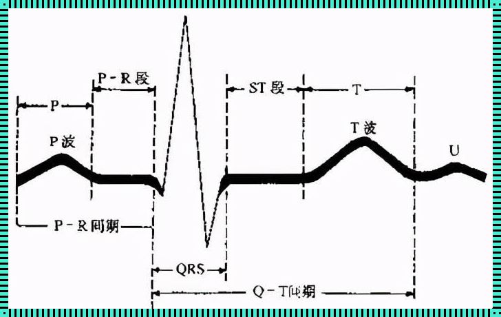 标准心电图：探寻生命律动的奥秘