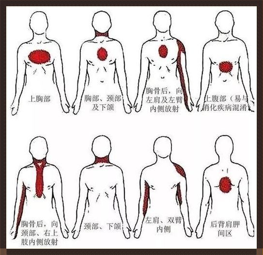 左肩膀酸痛和心梗有关系吗？探秘身体警讯的背后