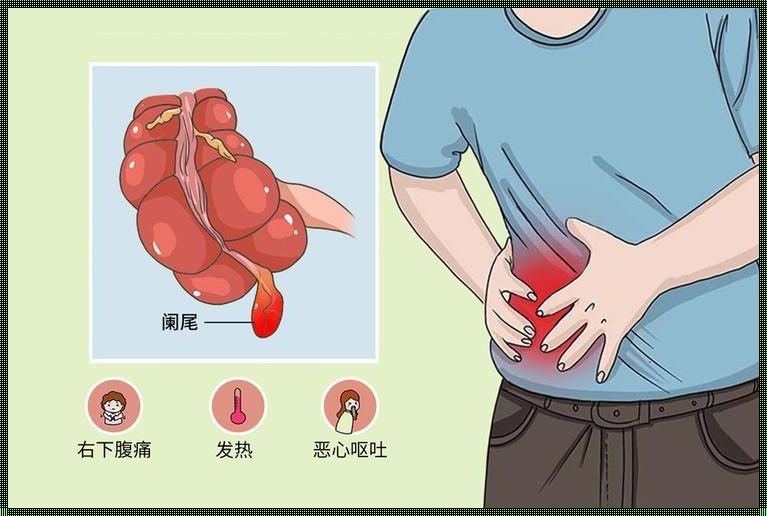 盲肠炎疼痛位置图解析：认识身体警讯