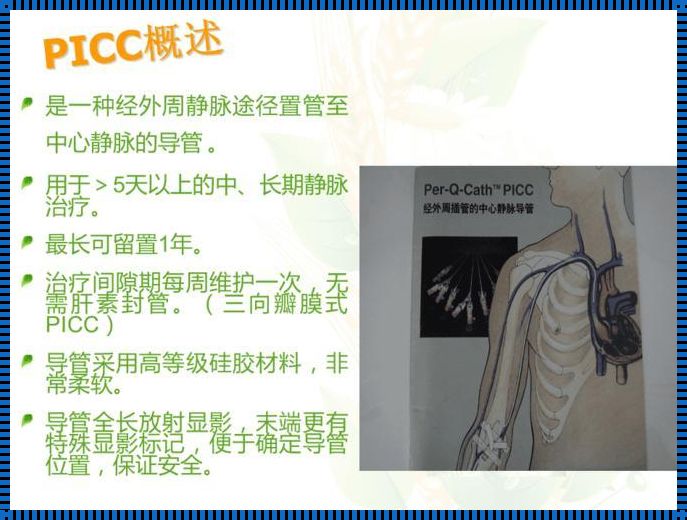 PICC导管简介——深入解析其优势与作用