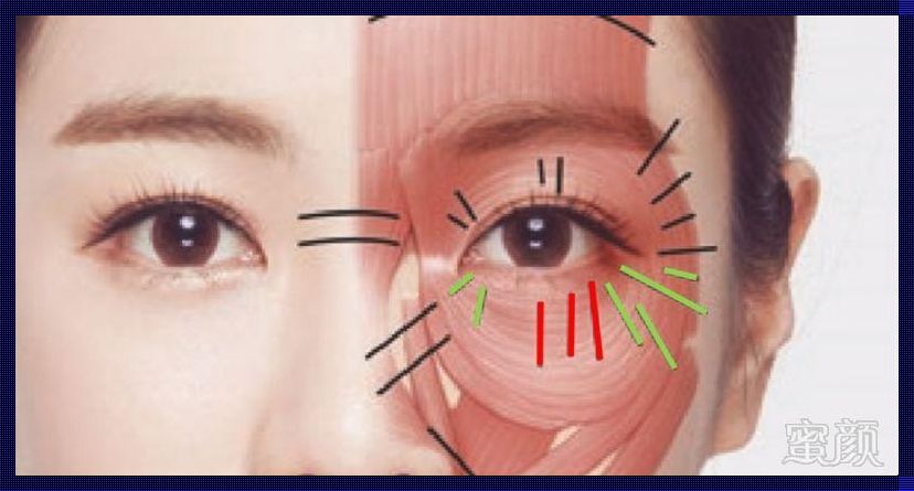 眼部除皱打在什么位置？探寻无痕青春的秘籍