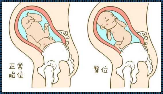 胎儿打嗝位置判断入盆：一位母亲的亲身体验