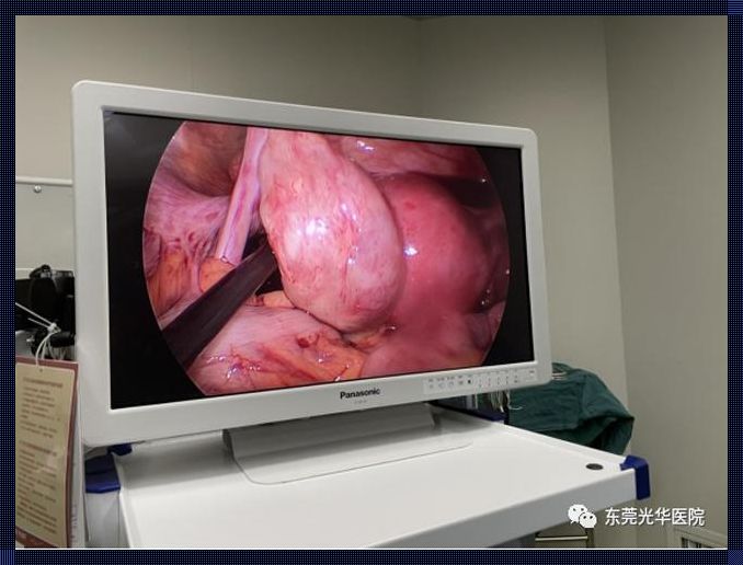 孕囊积液与肾上腺色腙片：一个医疗现象的深度解析