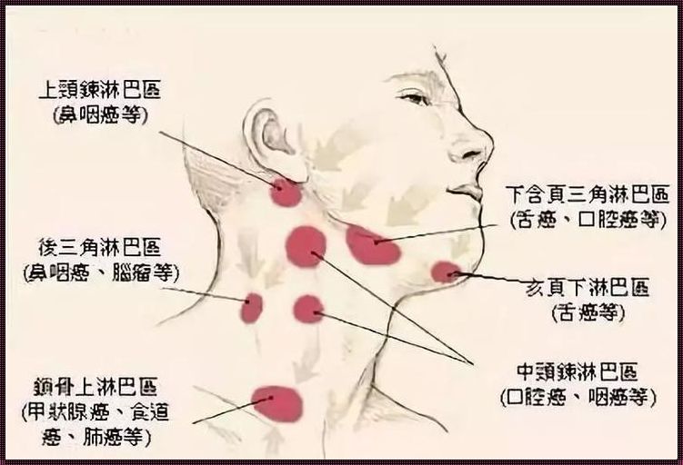 淋巴指的是身体哪个部位