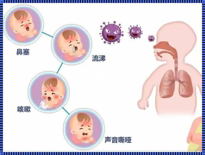 宝宝三凹征怎么治疗：关注与呵护