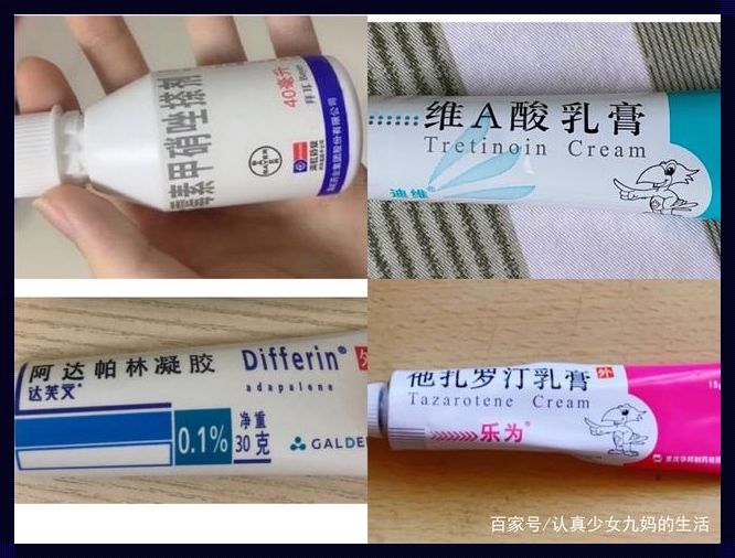 痤疮涂抹什么药膏？寻求专业指导