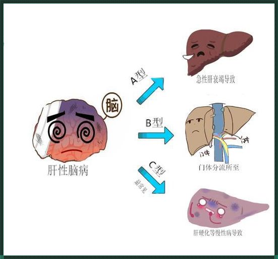 揭秘：肝脏与脑之间的神秘纽带——肝性脑病的诱因