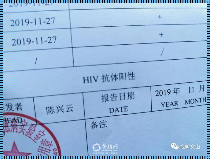 医院抽血HIV多久可以排除？揭秘加强检测的重要性