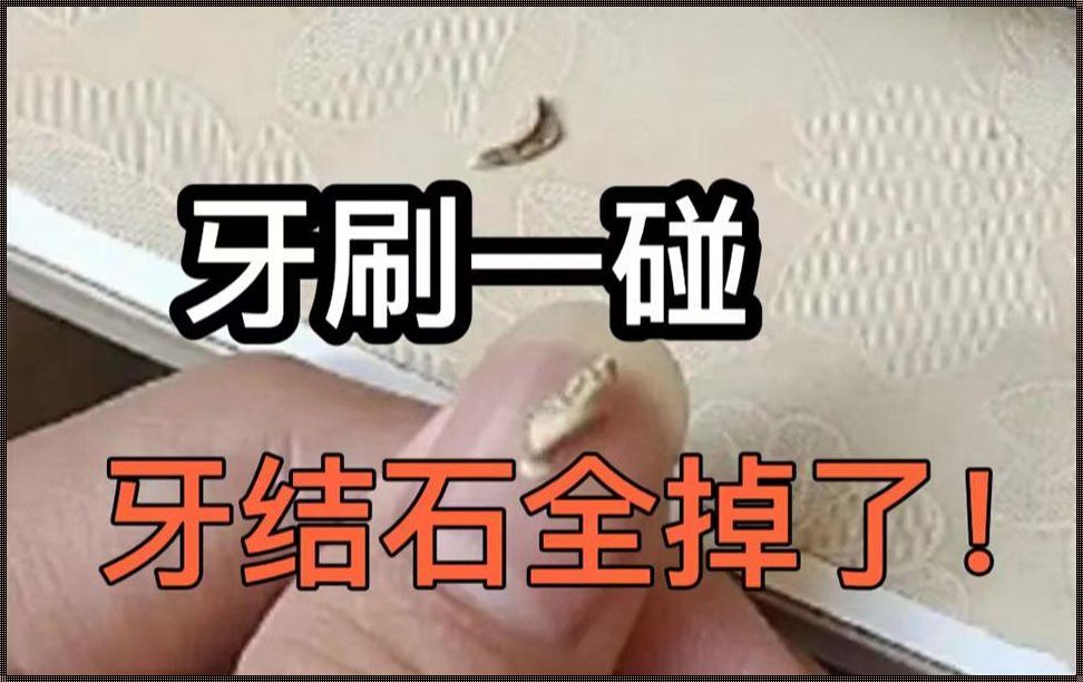 一招让牙结石自己排出来的神秘面纱