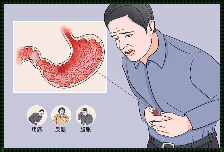 胃反酸喉咙有血：揭秘背后的健康隐患