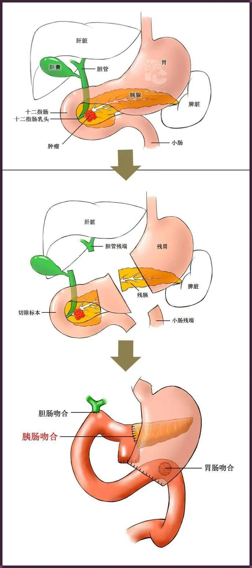 十二指肠：上下消化道界限的微观探秘