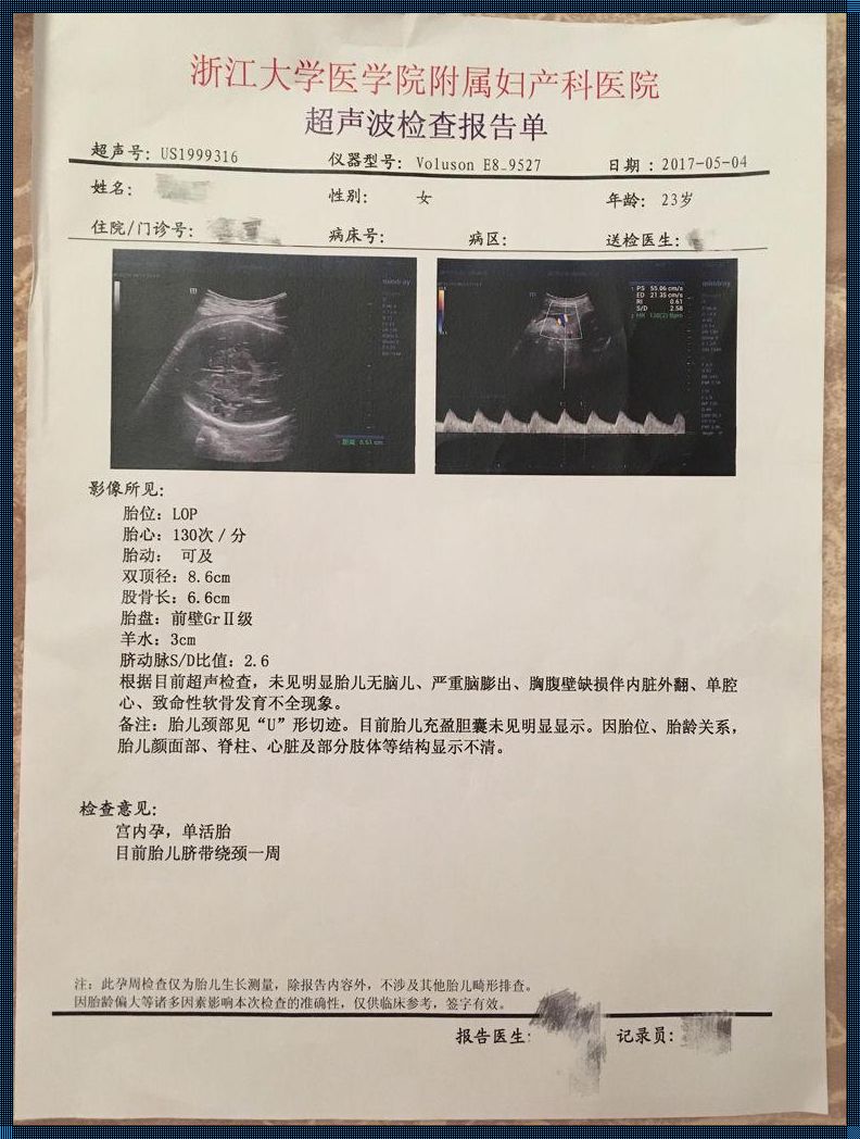 揭秘：医生收走产检报告的背后原因