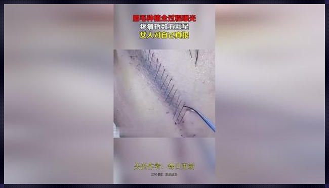 种植眉毛视频全过程：探寻美丽背后的科学与艺术