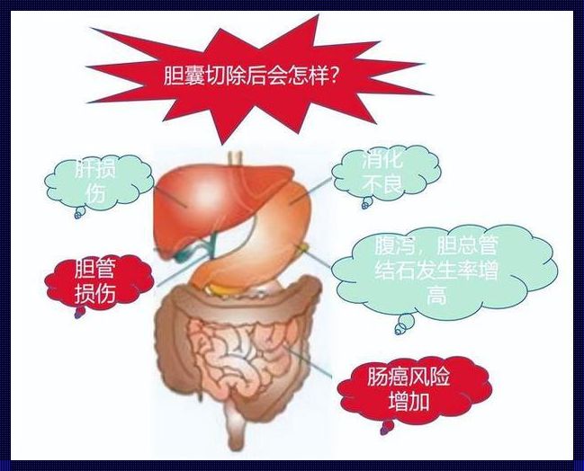 探秘保胆取石最佳医院：一份独特的排名指南