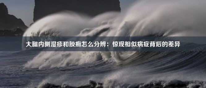 大腿内侧湿疹和股癣怎么分辨：惊现相似病症背后的差异