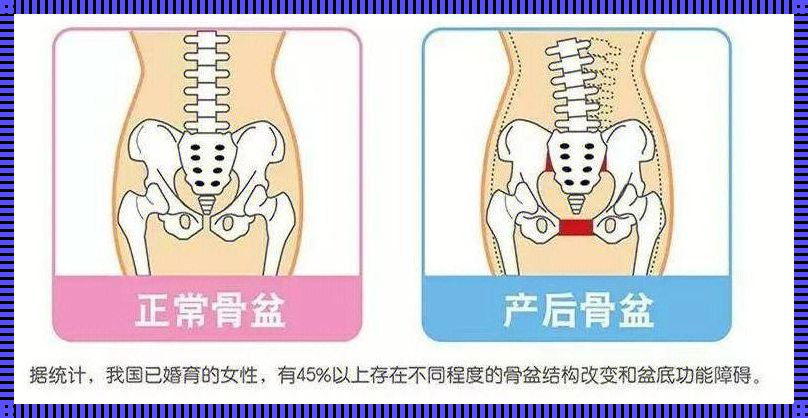 女性右侧盆骨隐痛，破解身体谜团的指南