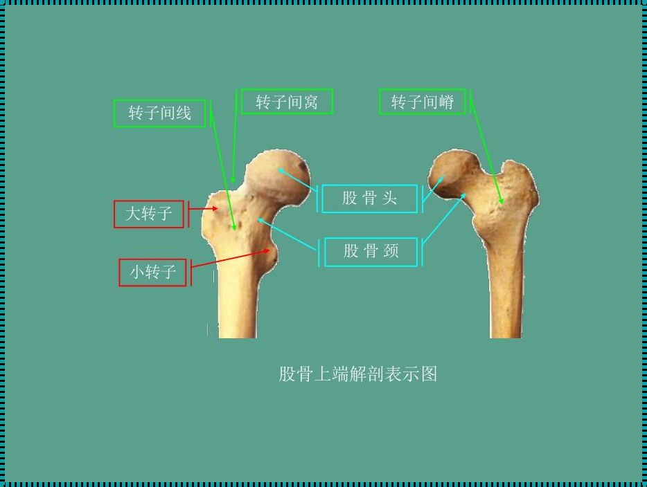 探秘股骨小转子的精准定位