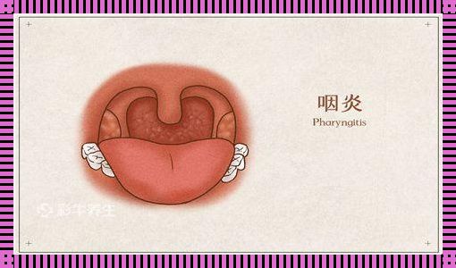 咽喉火辣辣，恶心涌心头：揭秘身体里的不适信号