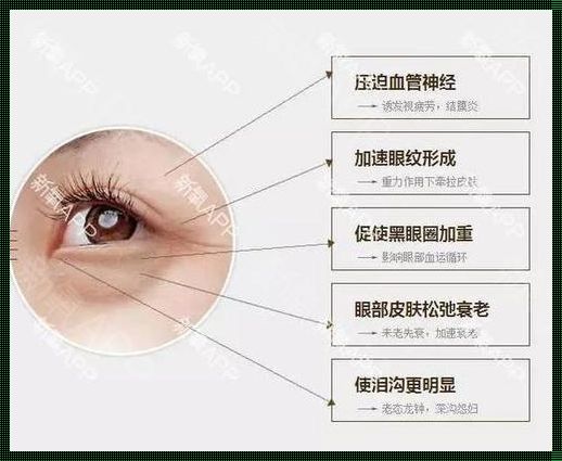 眼袋背后的健康密码：揭秘眼袋预示的疾病