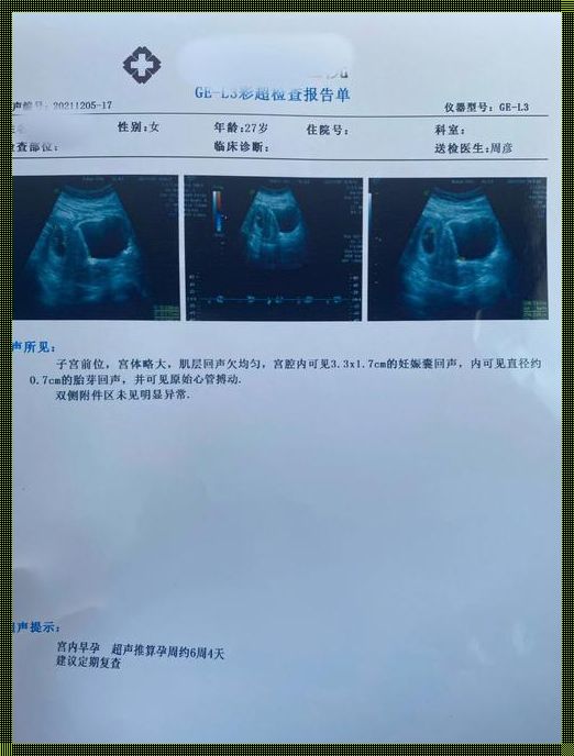 探索怀孕几周才会出现胎心胎芽的神秘之旅