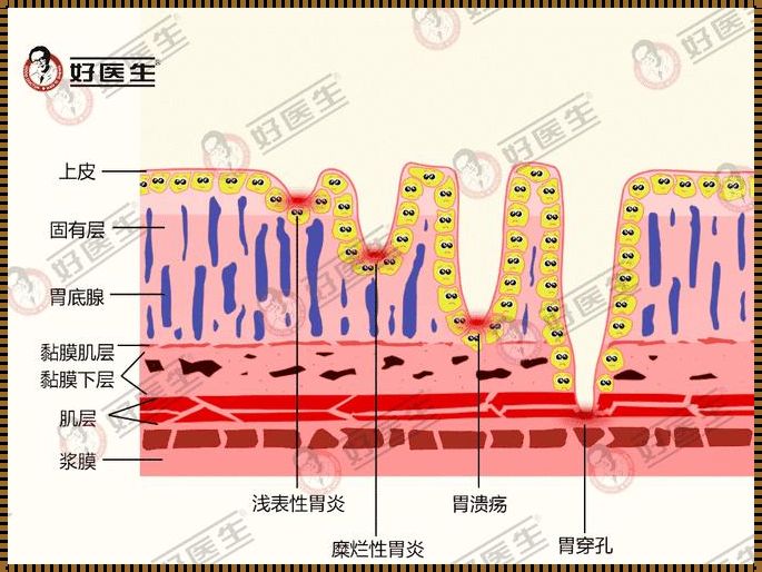 胃粘膜肌层属于哪一层：揭秘人体消化器官的神秘面纱