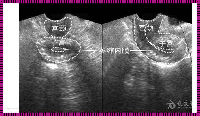 产科浅表超声：生命之初的细致探寻