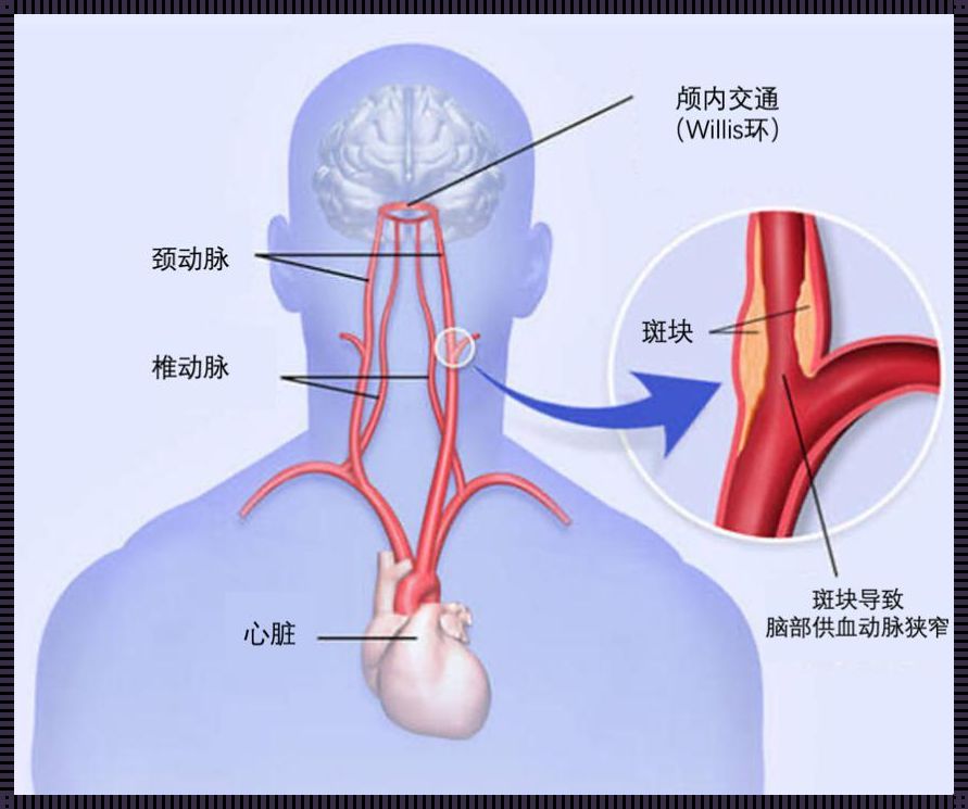 椎动脉v4段位置图：深入了解与探究