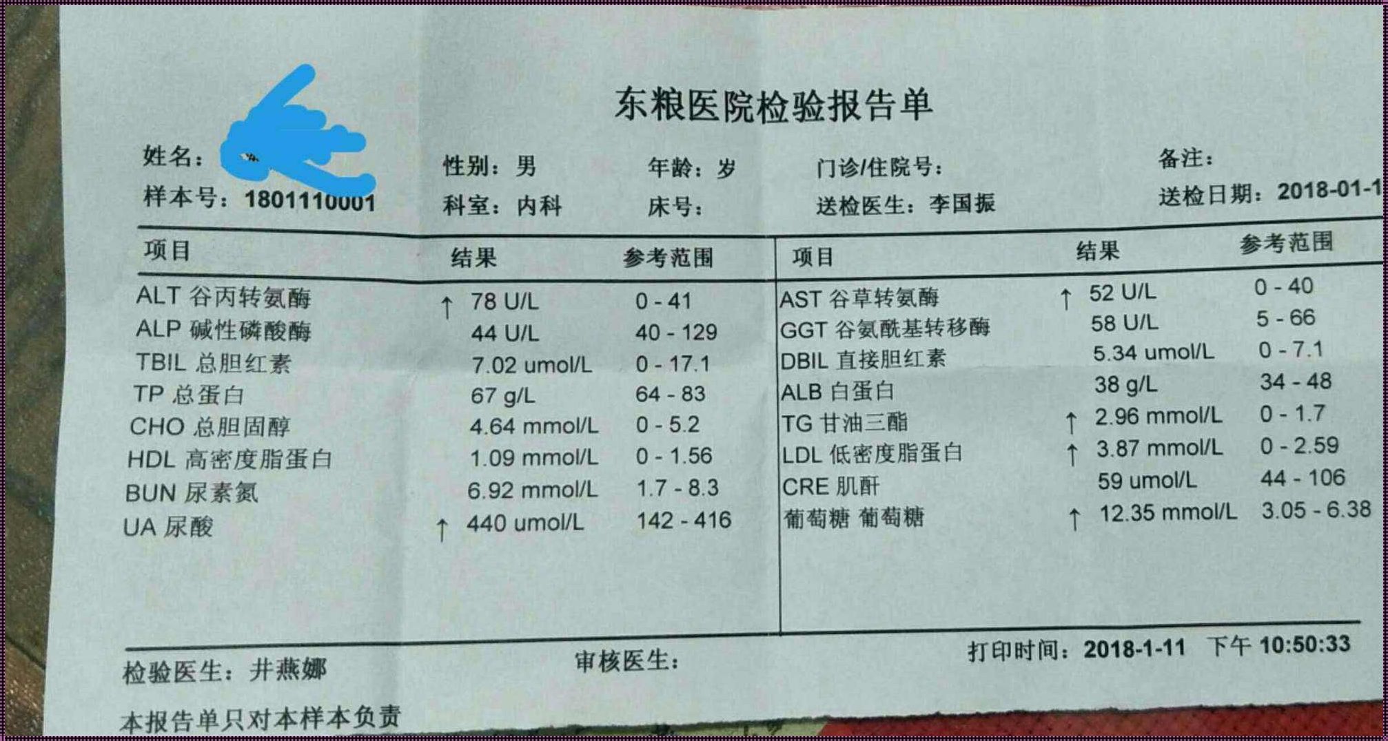 痛风没有急性发作能确诊吗