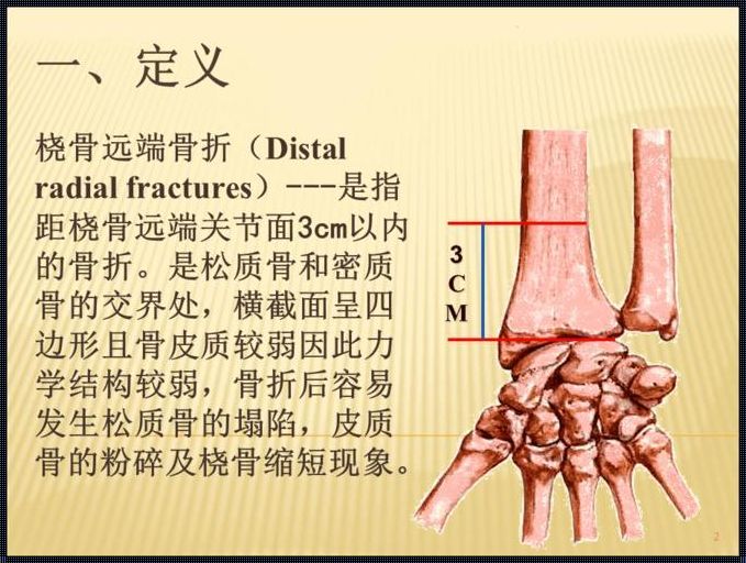 桡骨是哪个部位：探索人体奥秘的一扇窗