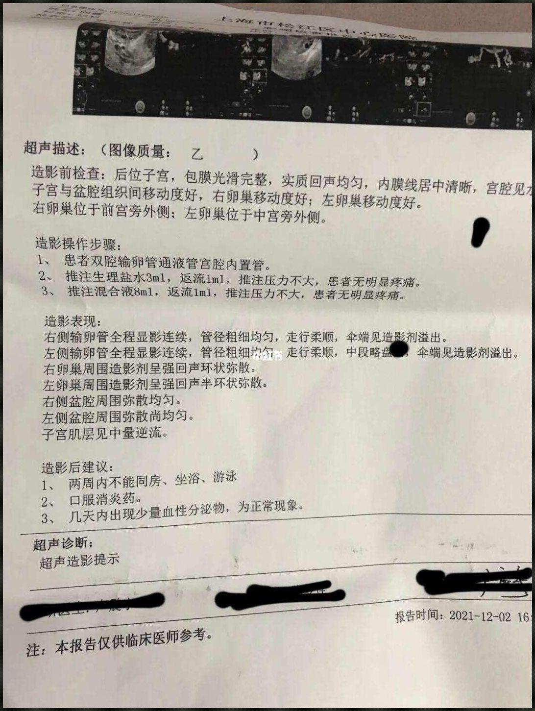 超声下输卵管造影多少钱：探秘医疗费用背后的故事