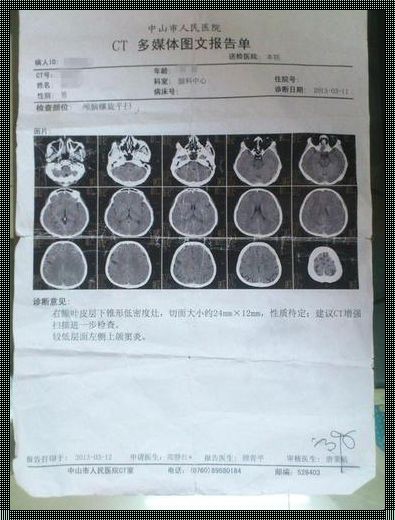 惊厥后建议做脑部CT吗？揭开神秘面纱