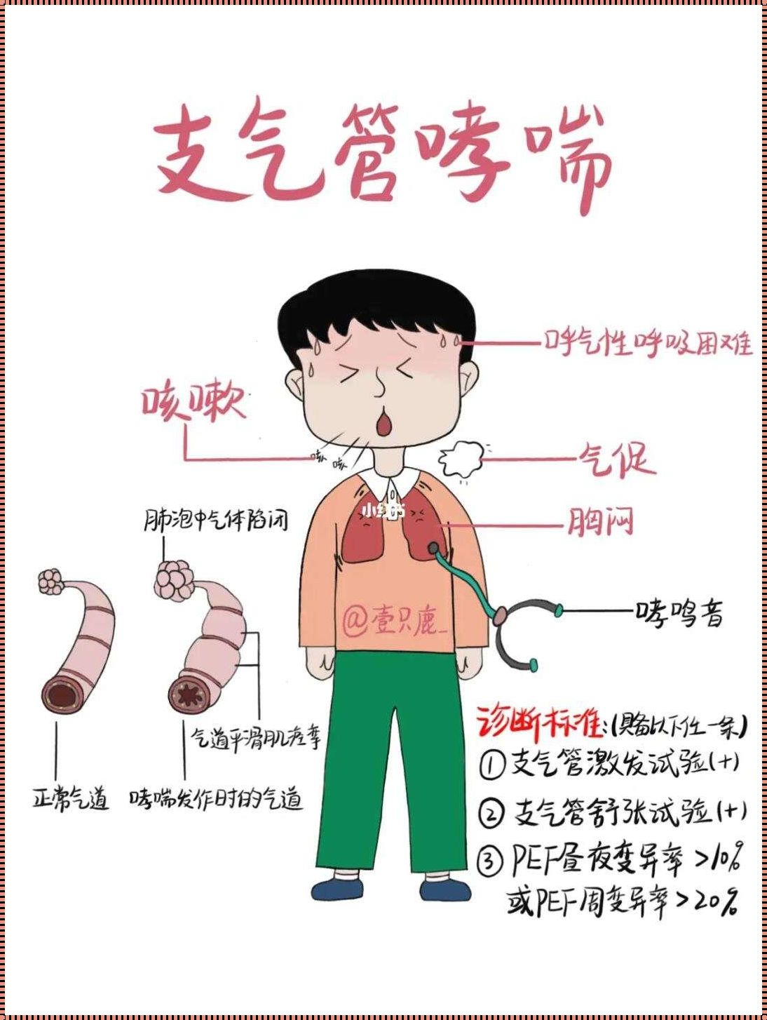 《呼吸之间：探索变异性哮喘的异彩症状》