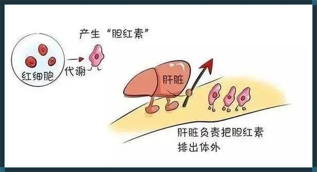 黄疸生成的原因：生命之光与暗影的交织