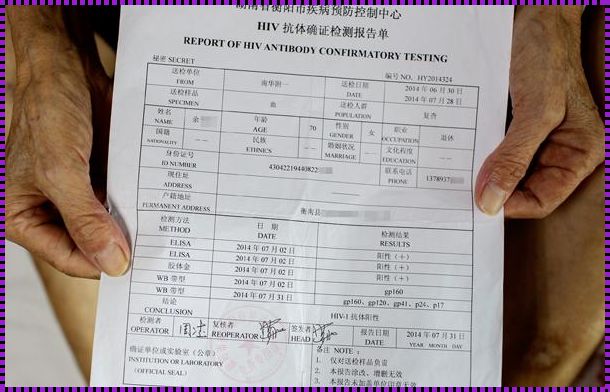 探寻未知领域：哪些地区对抗艾滋一个月抗体令人震惊?