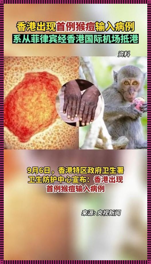 家中迎战猴痘：自我疗愈的智慧与艺术